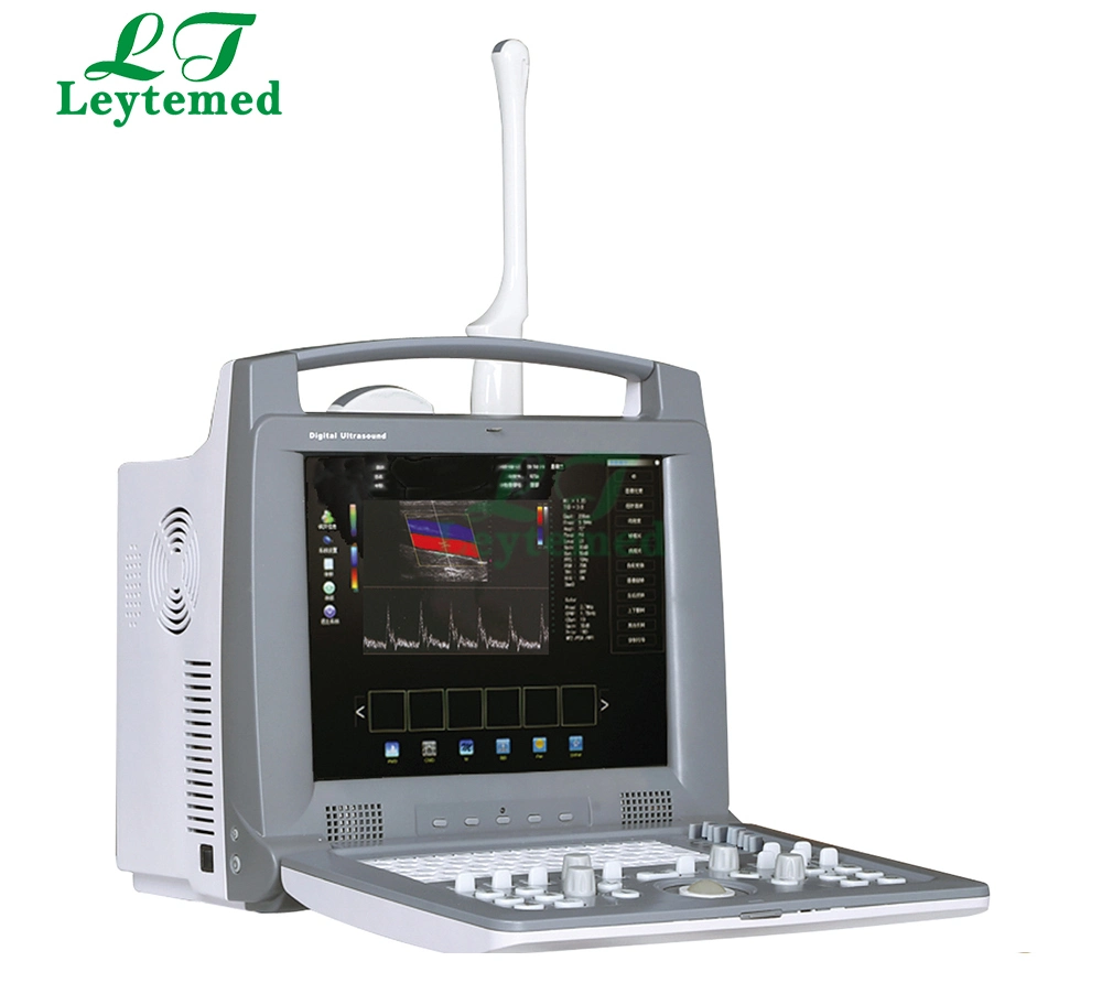 Ltub04 Digital Portable 3D Color Doppler Ultrasound Machine for Medical