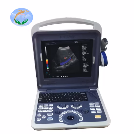 Medical Portable 12 Inch LED Full Digital Color Doppler Diagnostic Ultrasound Machine
